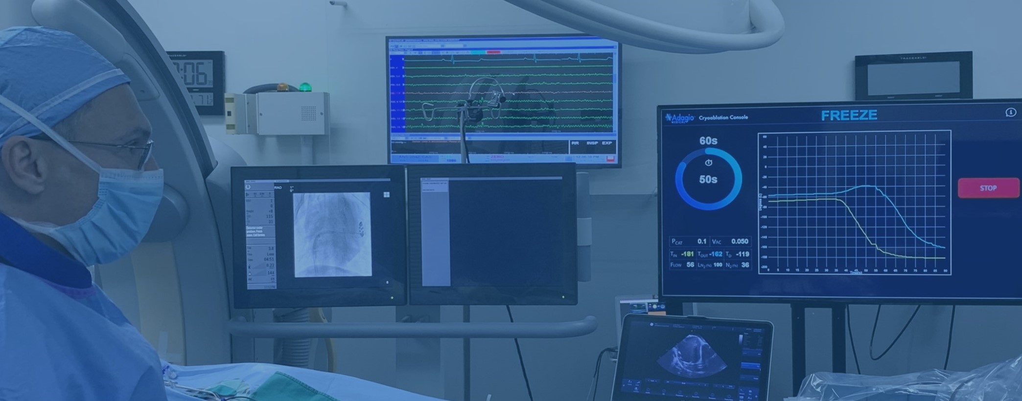 THE COOLEST CARDIAC ABLATION TECHNOLOGY